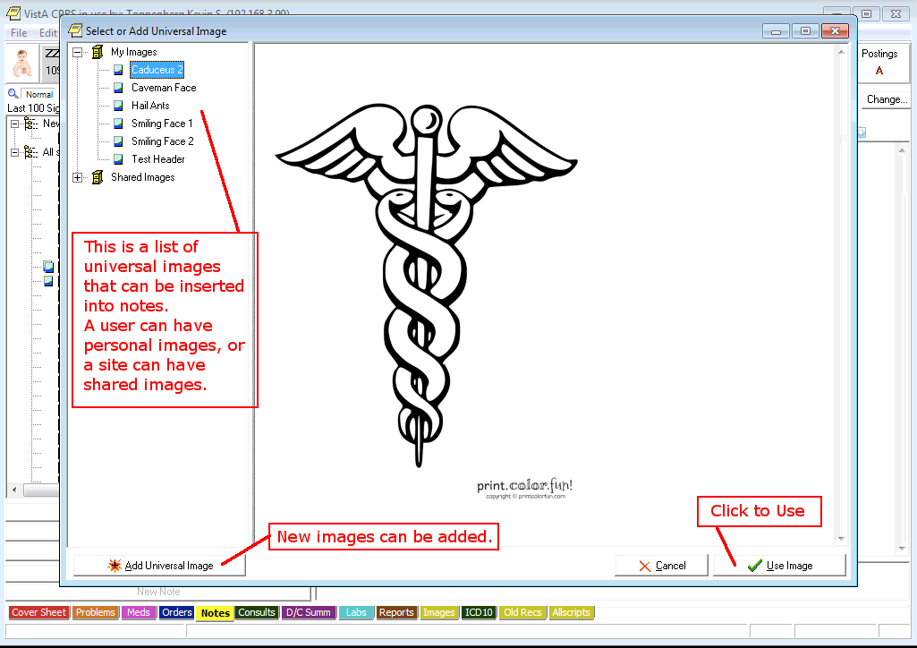 TMG-CPRS-NOTES-IMAGES-DEMO-7.PNG